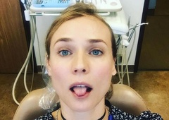 Zobozdravnik razkriva: "Na pregledu lahko opazimo, ali je pacient pred kratkim imel oralni seks"