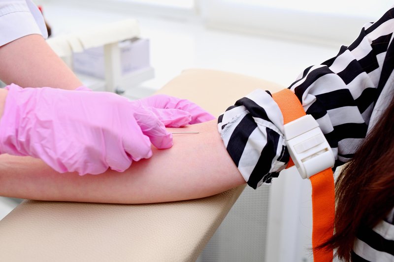 Znanstveniki so razvili krvni test, ki lahko z več kot 80-odstotno natančnostjo napove, ali boste umrli v naslednjih 10 letih. (foto: Profimedia)