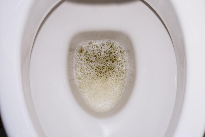 Wc skoljka - penast urin