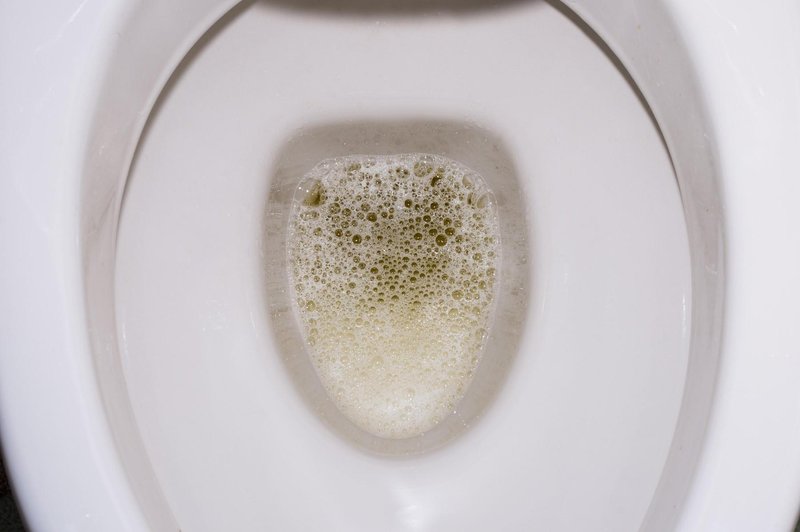 Bi vas moralo skrbeti, če se vaš urin peni? Ja, lahko je tudi resen opozorilni znak, ki zahteva takojšnje ukrepanje! (foto: Profimedia)