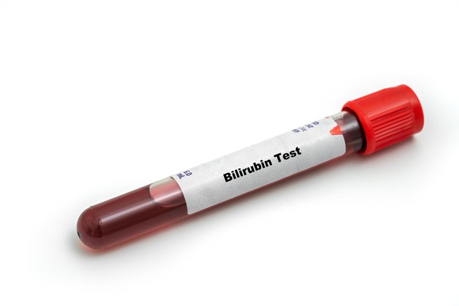 Bilirubin test