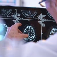 Verjamete vanje? To je 10 najpogostejših mitov in zmot o možganski kapi