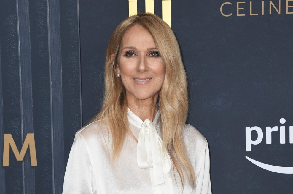 Simptomi sindroma toge osebe: bi znali prepoznati bolezen, ki je prizadela Celine Dion? (foto: Profimedia)