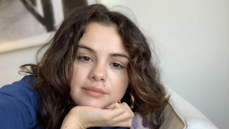 "Samo pogledam obraz in takoj vem, s katerimi živili pretiravate": dermatologinja razkriva, katera hrana pušča največ posledic na vaši koži