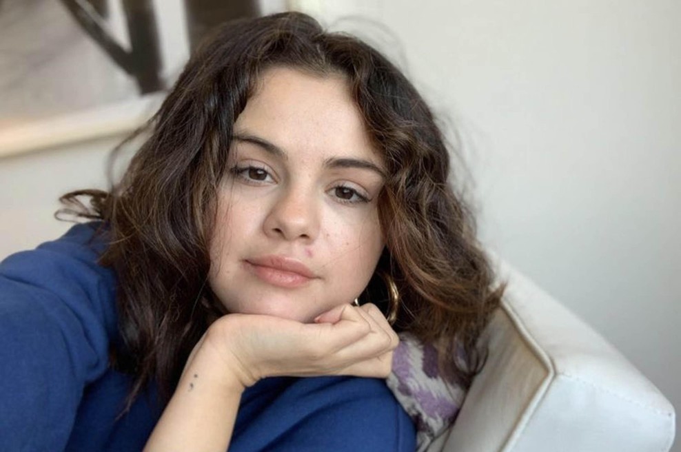 "Samo pogledam obraz in takoj vem, s katerimi živili pretiravate": dermatologinja razkriva, katera hrana pušča največ posledic na vaši koži (foto: Profimedia)
