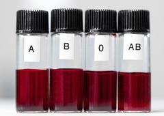 Imate to krvno skupino? Strokovnjaki opozarjajo da je povezana z nastankom sladkorne bolezni