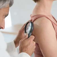 Najpogostejša vrsta raka prizadene vsako peto osebo: dermatologinja svetuje, kako jo prepoznati in kako preprečiti nastanek