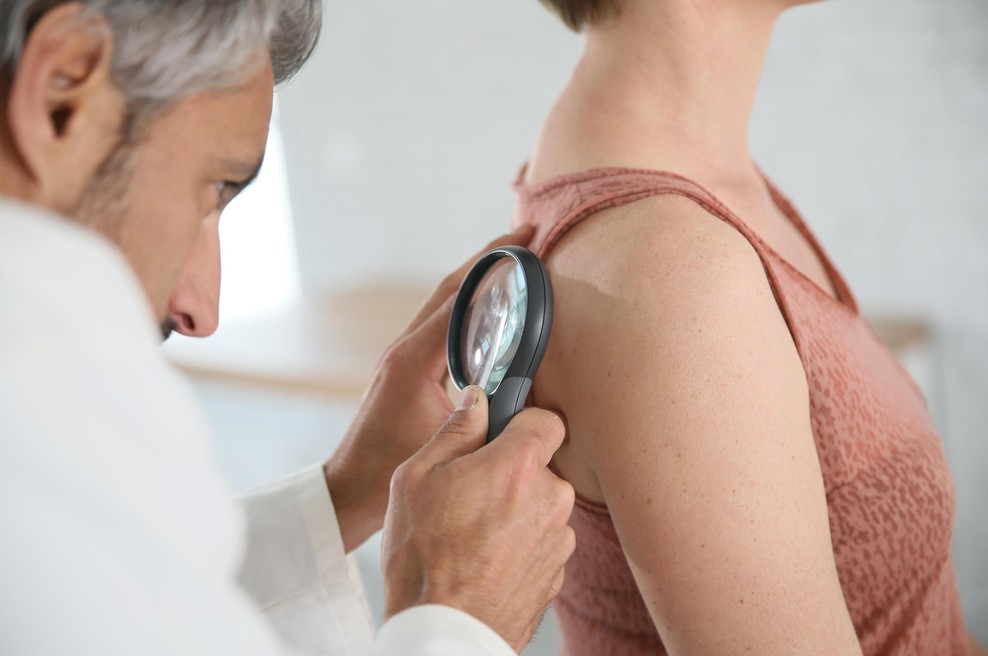 Najpogostejša vrsta raka prizadene vsako peto osebo: dermatologinja svetuje, kako jo prepoznati in kako preprečiti nastanek (foto: Profimedia)