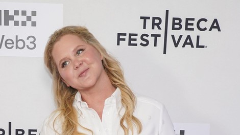 Amy Schumer je opazno shujšala, oboževalci pa so na novih fotografijah opazili tudi ta zaskrbljujoč detajl