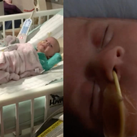 Dvojčicama so kmalu po rojstvu diagnosticirali raka: prvi znak je bil viden na fotografijah, mama pa ga je spregledala