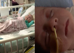 Dvojčicama so kmalu po rojstvu diagnosticirali raka: prvi znak je bil viden na fotografijah, mama pa ga je spregledala