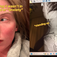 Mladi mamici so zdravniki zagotavljali, da je vse v njeni glavi: izvidi so povsem šokirali