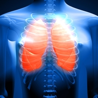 Kako preprečiti obojestransko pljučnico? Zdravnik razkriva, kdo je najbolj ogrožen in kdaj bolezen postane nevarna