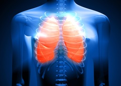 Kako preprečiti obojestransko pljučnico? Zdravnik razkriva, kdo je najbolj ogrožen in kdaj bolezen postane nevarna