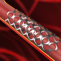 Kaj lahko pričakujete pred in po vstavitvi stenta? Od koristi do možnih zapletov