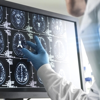 Nevrolog razkriva navado, ki se ji izogiba, saj dolgoročno uničuje možgane: "Ljudje mislijo, da je neškodljiva, a v resnici …"