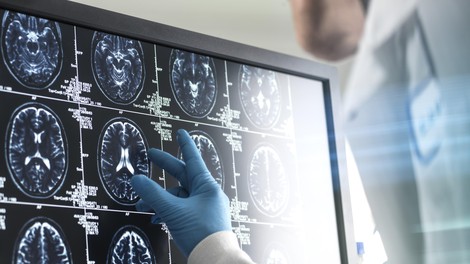 Nevrolog razkriva navado, ki se ji izogiba, saj dolgoročno uničuje možgane: "Ljudje mislijo, da je neškodljiva, a v resnici …"