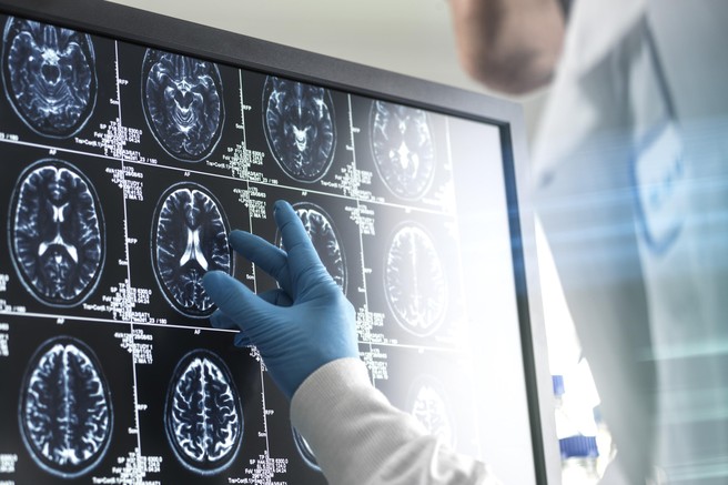 Nevrolog razkriva navado, ki se ji izogiba, saj dolgoročno uničuje možgane: "Ljudje mislijo, da je neškodljiva, a v resnici …"