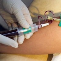 Krvni test lahko razkrije biološko starost vaših možganov in srca ter napove tveganje za bolezni
