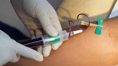 Krvni test lahko razkrije biološko starost vaših možganov in srca ter napove tveganje za bolezni