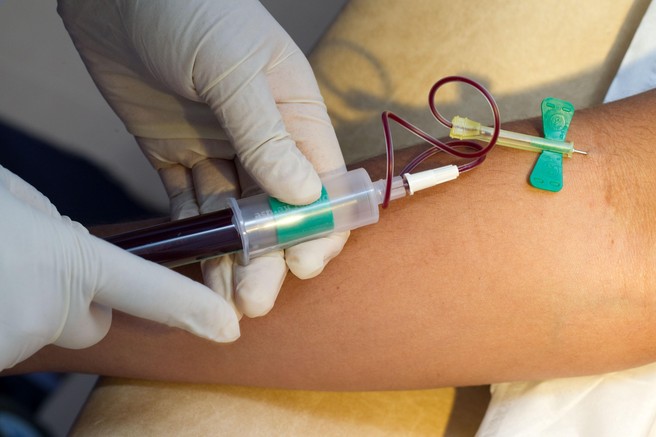 Krvni test lahko razkrije biološko starost vaših možganov in srca ter napove tveganje za bolezni
