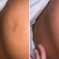 Zbudila jo je bolečina, na svojem nosečniškem trebuhu pa je opazila nenavadno dogajanje: odhitela je k zdravniku in odkrila resnico