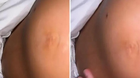 Zbudila jo je bolečina, na svojem nosečniškem trebuhu pa je opazila nenavadno dogajanje: odhitela je k zdravniku in odkrila resnico