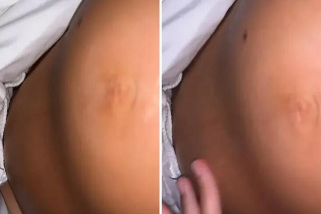 Zbudila jo je bolečina, na svojem nosečniškem trebuhu pa je opazila nenavadno dogajanje: odhitela je k zdravniku in odkrila resnico