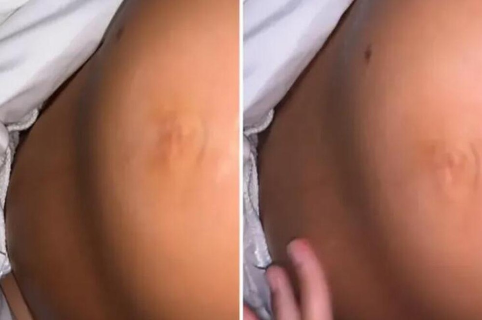 Zbudila jo je bolečina, na svojem nosečniškem trebuhu pa je opazila nenavadno dogajanje: odhitela je k zdravniku in odkrila resnico (foto: Instagram / Posnetek zaslona)