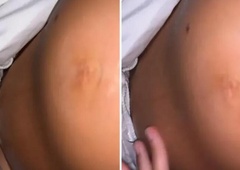 Zbudila jo je bolečina, na svojem nosečniškem trebuhu pa je opazila nenavadno dogajanje: odhitela je k zdravniku in odkrila resnico