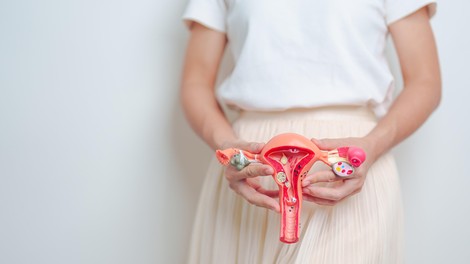Nikar jih ne prezrite: to so znaki, ki lahko kažejo na PCOS
